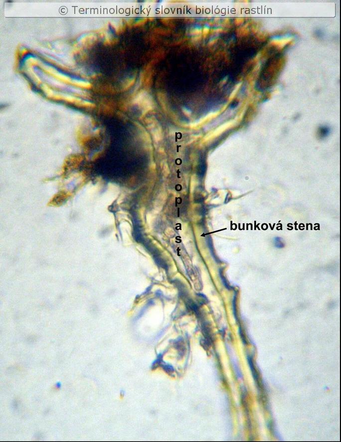 astrosklereida 1