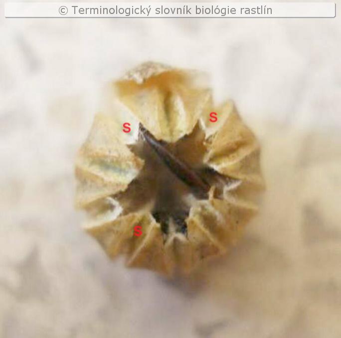 septic�dny 1