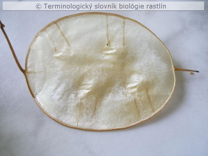 diafragma 1