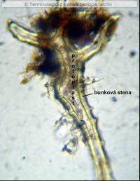 astrosklereida 1