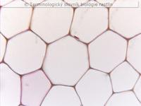parench�m